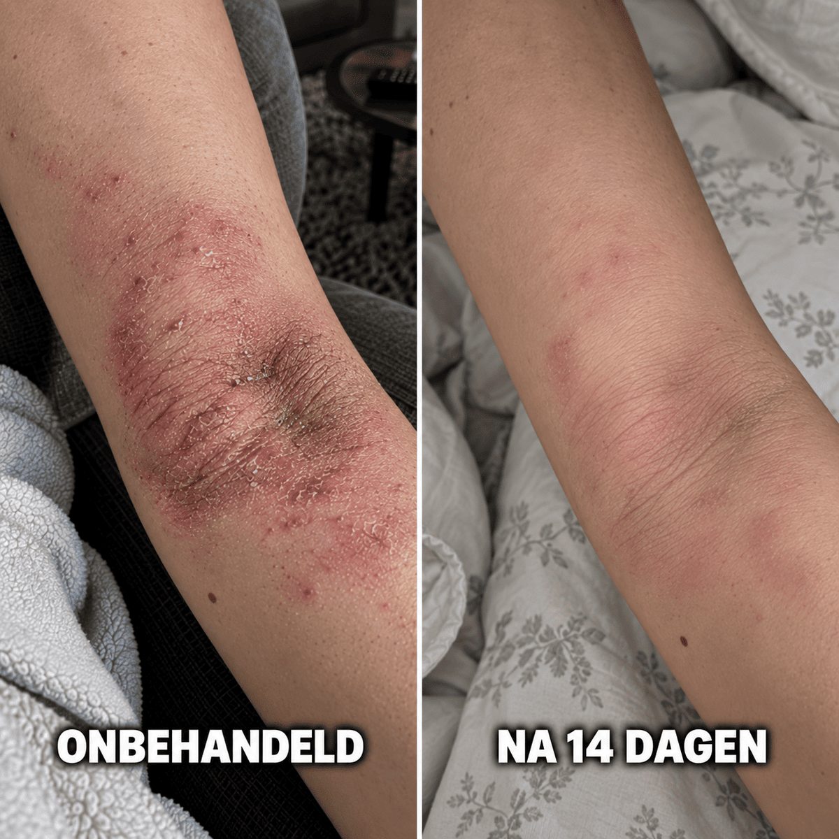 De Complete Huidherstel Kuur