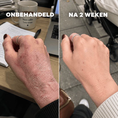 De Complete Huidherstel Kuur