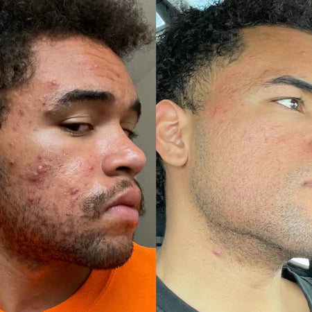 Dermatoloog_onthult_waarom_parfumvrij_cremes_toch_je_huid_irriteren_4.webp__PID:25f0e09c-c590-4f90-8d6c-6573ba77d55d