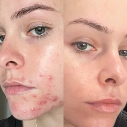 Reguliere crémes (2).png__PID:5cc5dcd2-356e-41a5-9166-f187f4192bdc