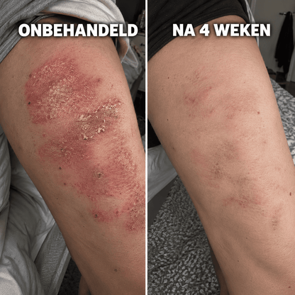 De Complete Huidherstel Kuur