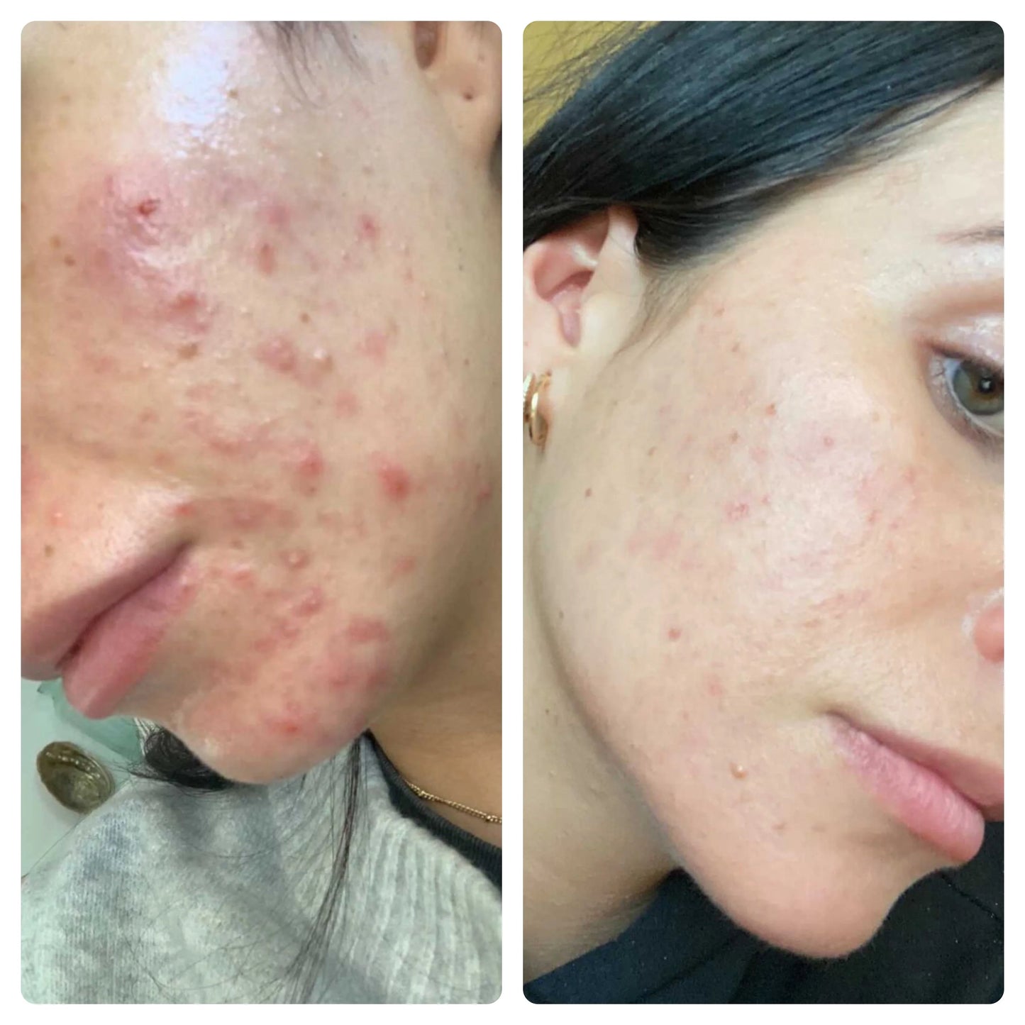 Beef Tallow Balm Halal verzorging